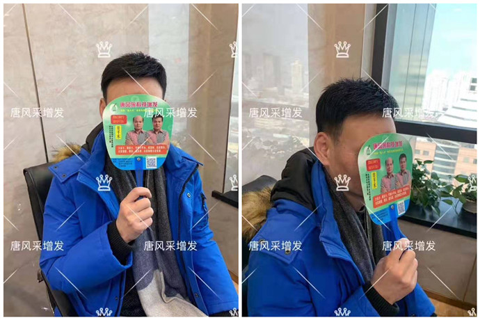 假發(fā)什么牌子質(zhì)量好 \