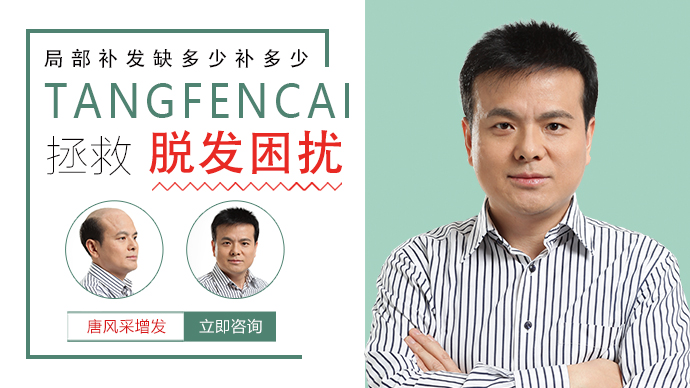 男士假發(fā)會掉嗎 \