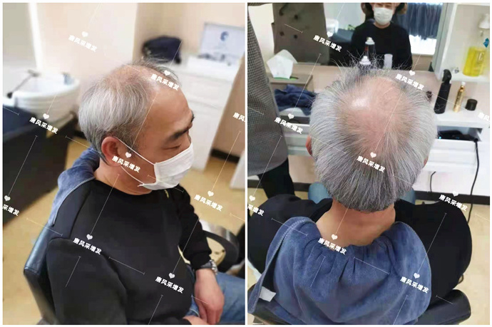 白色假發(fā)套 \