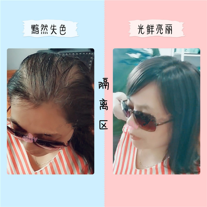 假發(fā)定制多少錢 \
