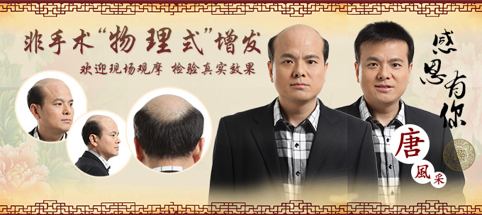 假發(fā)定制多少錢 \
