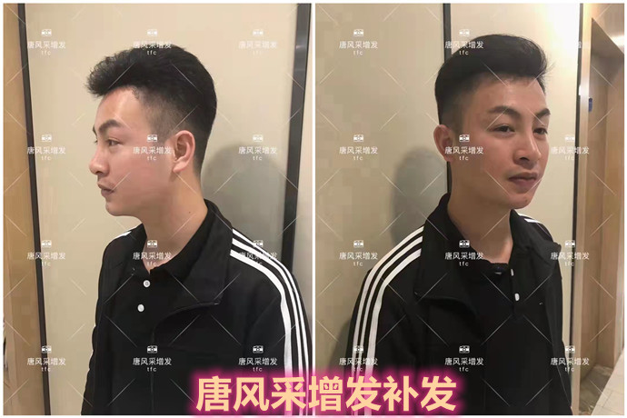 補(bǔ)發(fā)效果 \