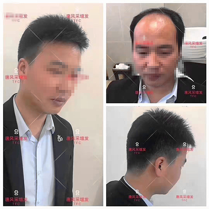 男士假發(fā)定制要多久時(shí)間 \