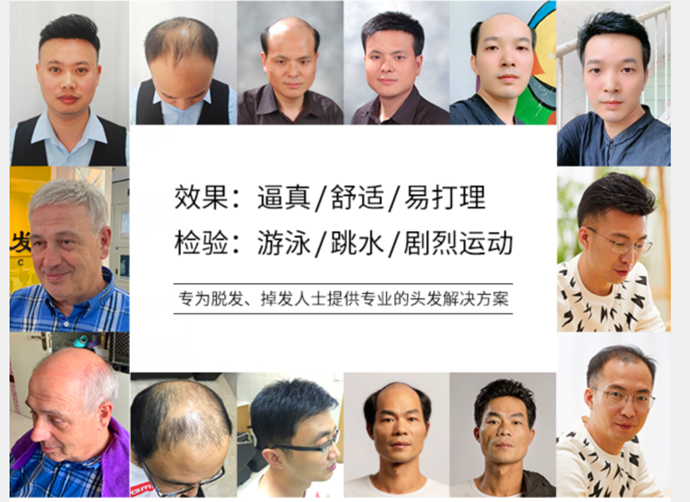實(shí)體店買(mǎi)假發(fā) \