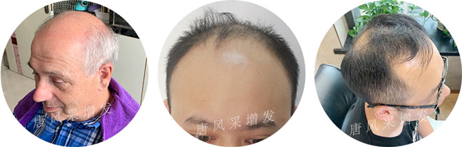 男士增發(fā)補(bǔ)發(fā)實(shí)體店 \