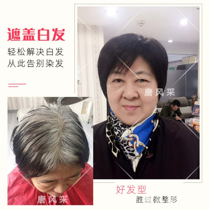 唐風采定制局部假發(fā) \