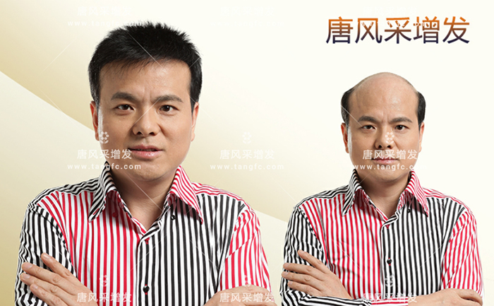 假發(fā)定做實體店 \