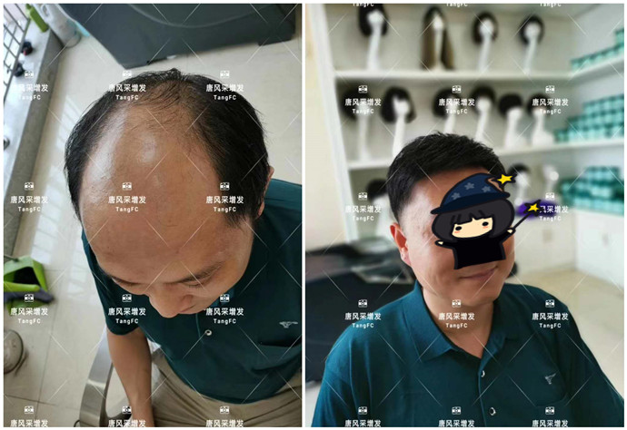 男士真發(fā)假發(fā)在哪可以定做 \