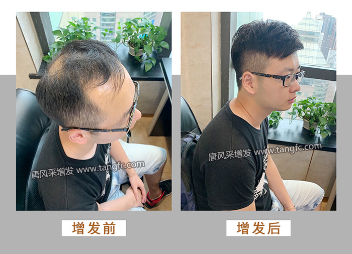 男士購(gòu)買(mǎi)假發(fā) \