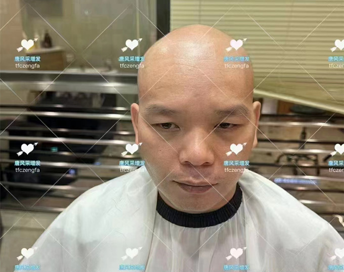 頭發(fā)太少,剃光頭 \