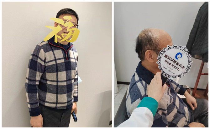 西寧假發(fā)設計 \