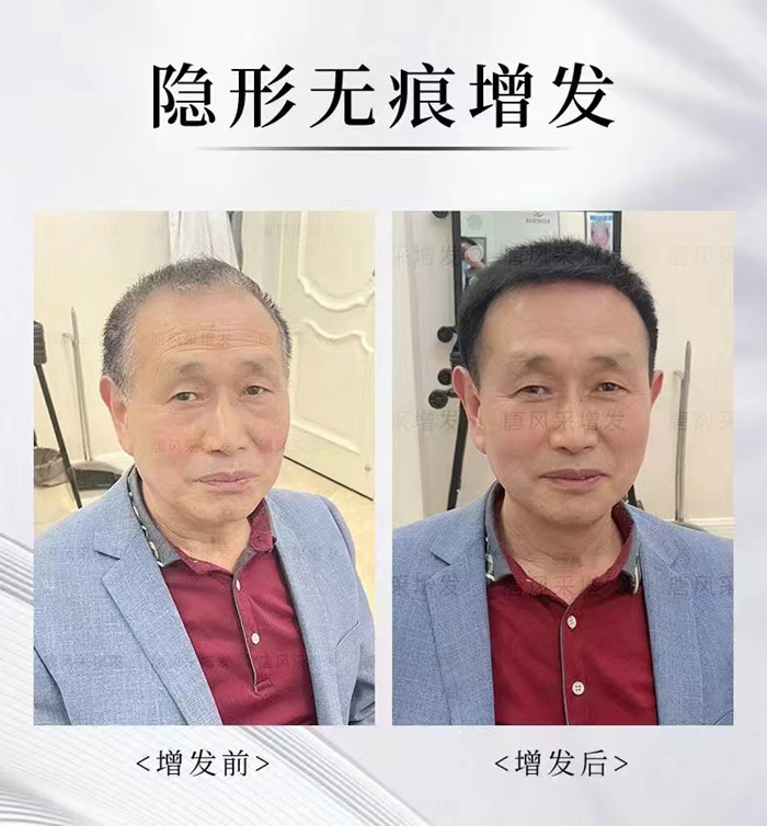 無痕增發(fā) \