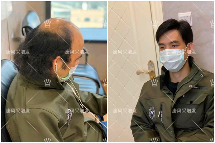 無痕增發(fā) \
