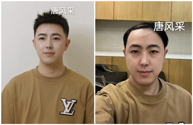 無痕增發(fā) \