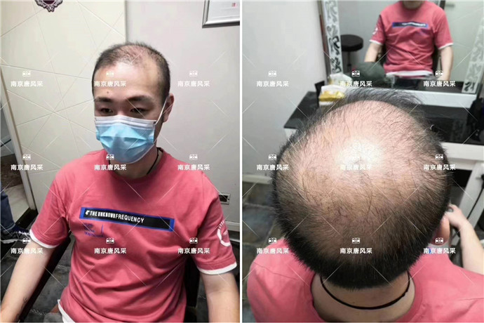 無痕增發(fā) \