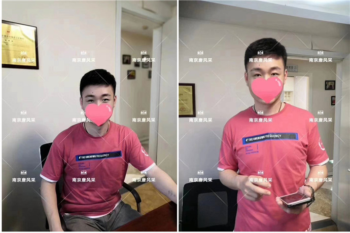 無痕增發(fā) \