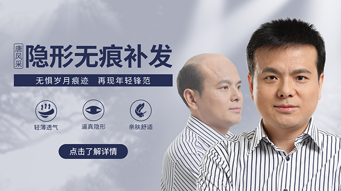 石家莊男士假發(fā)哪家強(qiáng) \