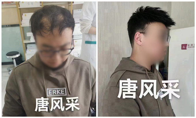 郴州假發(fā)購(gòu)買 \