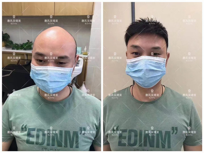 郴州假發(fā)購(gòu)買 \