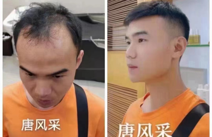 補發(fā)假發(fā) \