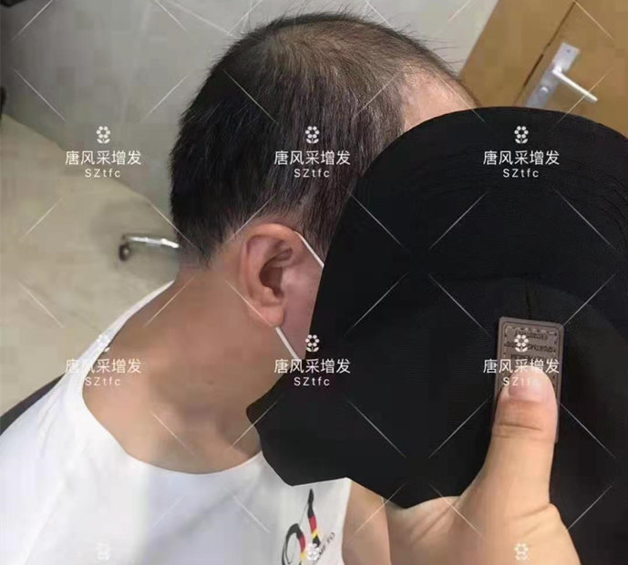 補發(fā)假發(fā) \