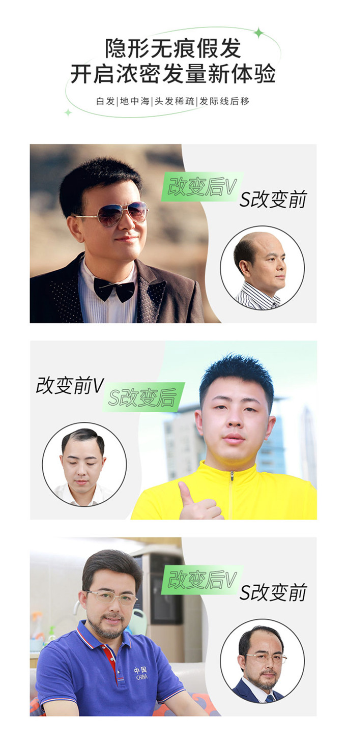 長沙芙蓉區(qū)假發(fā)店 \