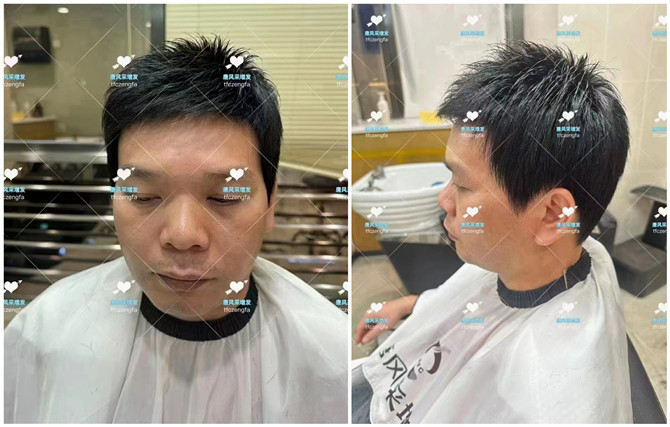 長沙芙蓉區(qū)哪有假發(fā)店 \