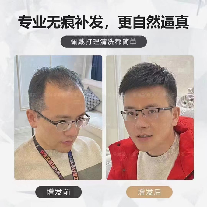 沈陽(yáng)假發(fā)店哪能找到 \