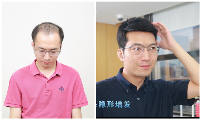 沈陽(yáng)假發(fā)店哪能找到 \