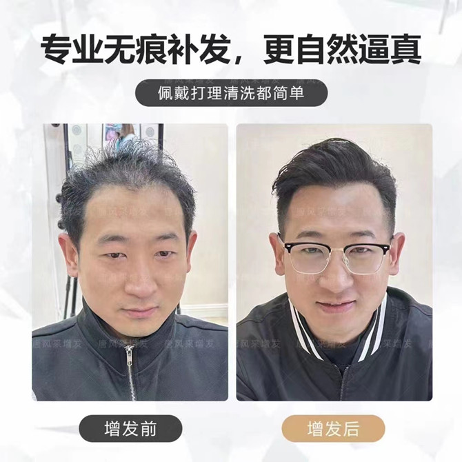 延安假發(fā)定制實(shí)體店 \