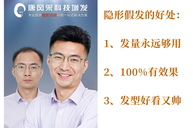 成都哪有品質(zhì)假發(fā)店 \