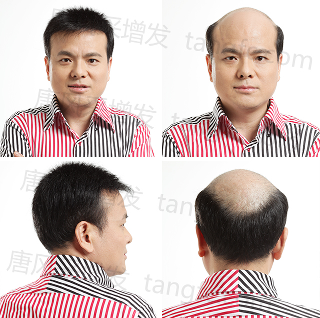 朝陽男士假發(fā)店 \
