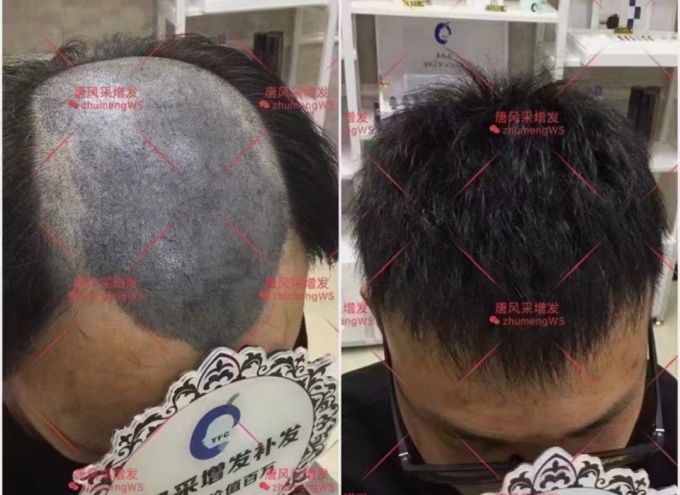 唐風(fēng)采武漢假發(fā)實(shí)體店 \