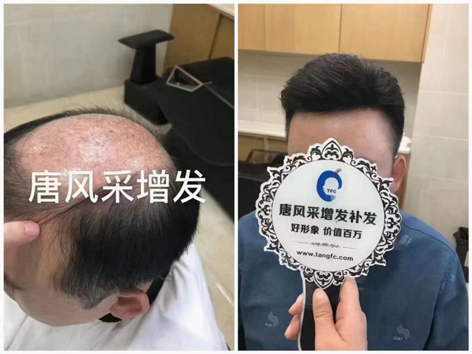唐風(fēng)采武漢假發(fā)實(shí)體店 \