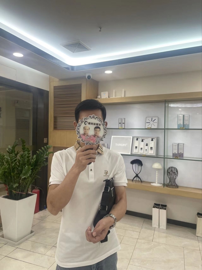 稀疏頭發(fā) \