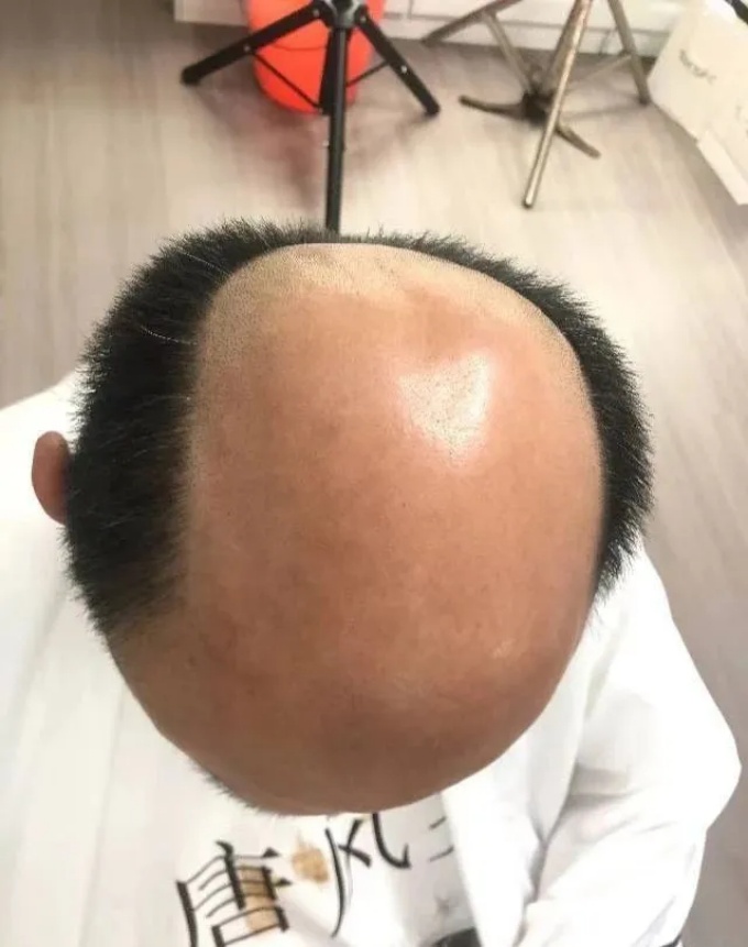 溫州男假發(fā)定制 \